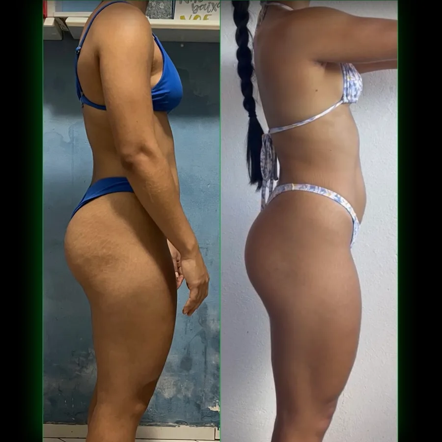Antes e depois de aluna do LFTEAM